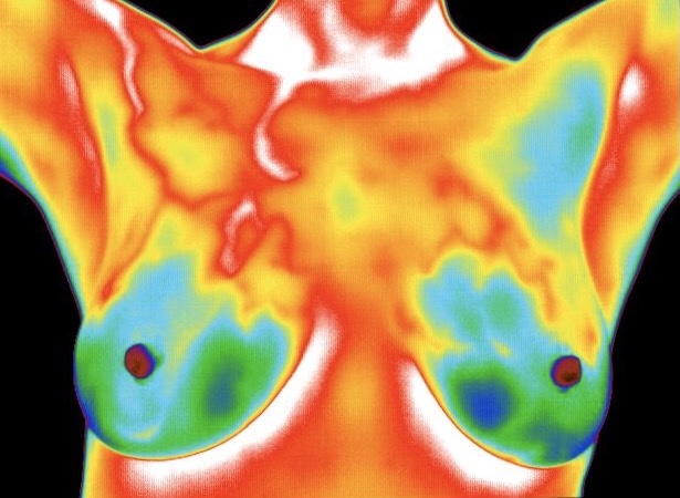 Cincinnati Breast Thermography Home